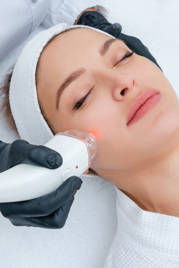 Lasers Skinscholar Lasers Skinscholar