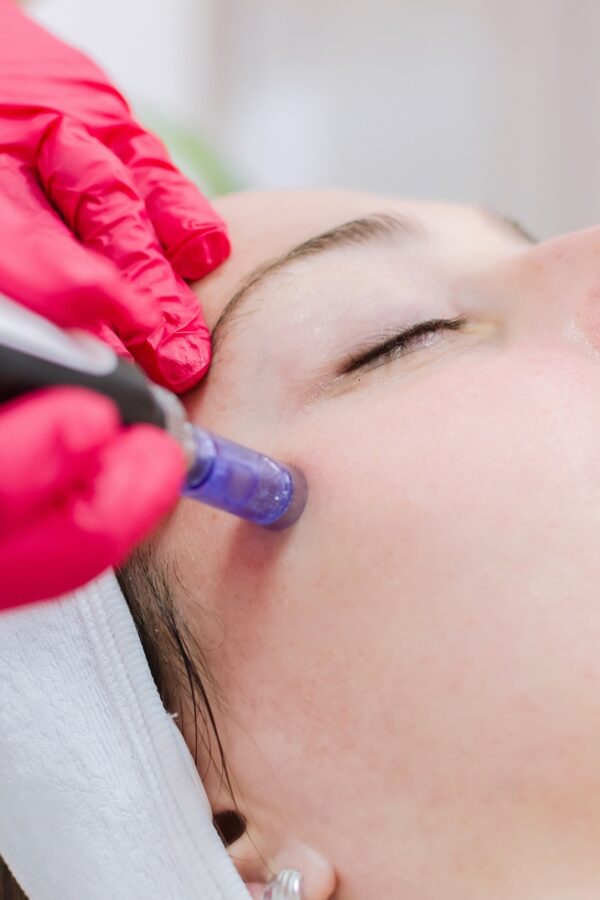 dermapen face spa treatment dermapen face spa treatment